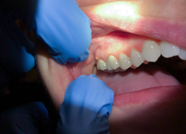 Best Pediatric Emergency Dentist in Marysville, OH