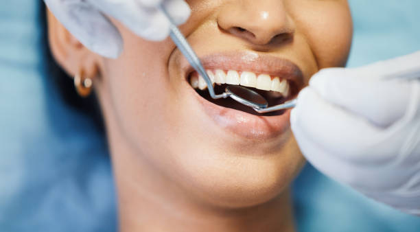Best Emergency Tooth Extraction in Marysville, OH
